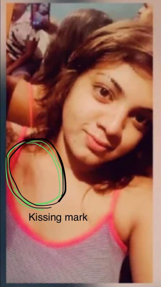 hot college girl bite mark dikhati